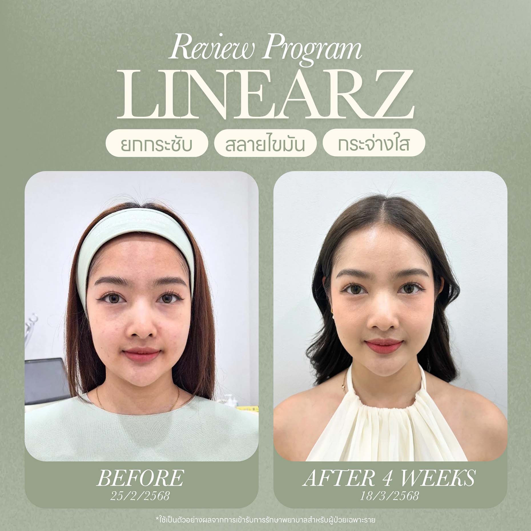 ออกแบบภาพกราฟิก Website 09-25 - Lily Nice Clinic-1