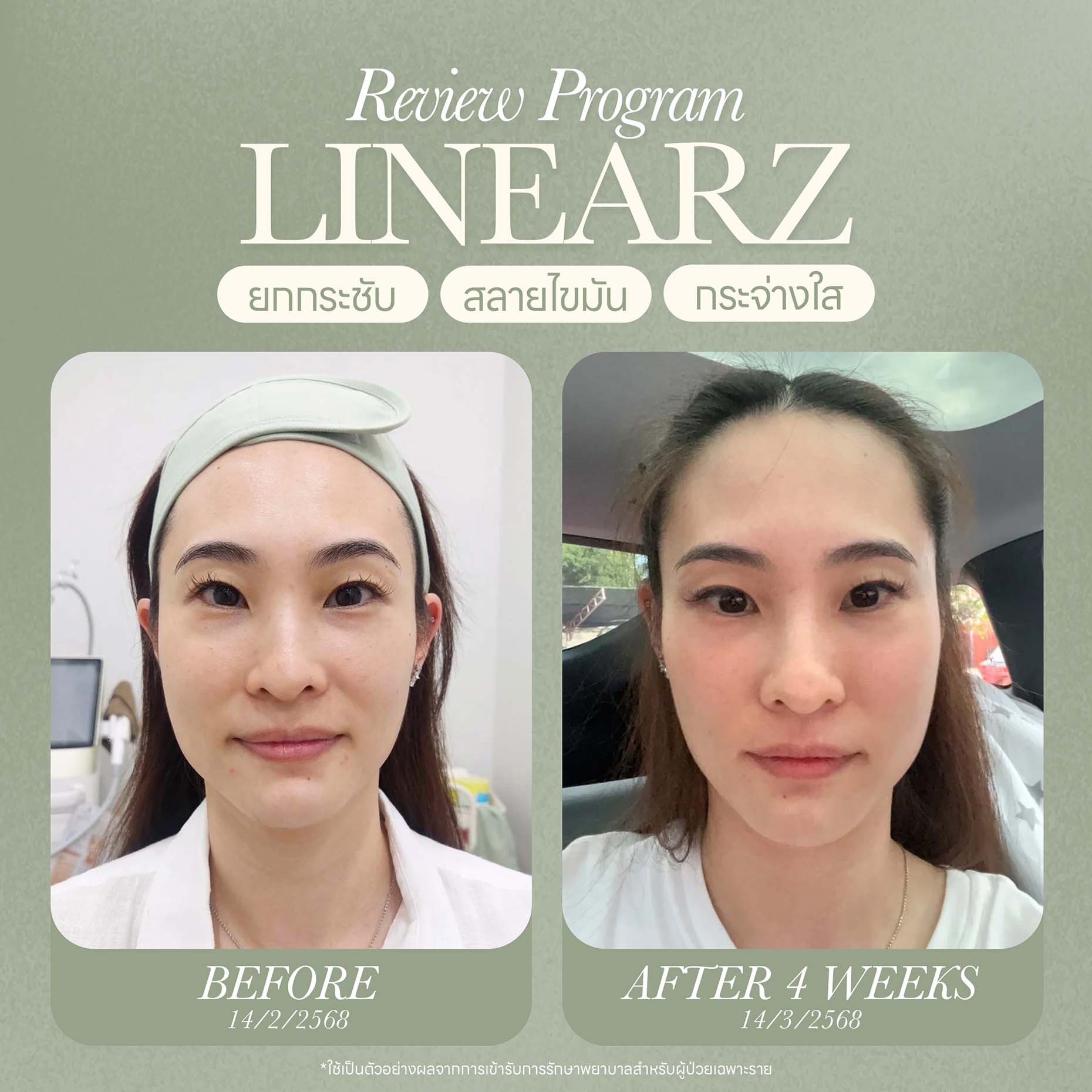ออกแบบภาพกราฟิก Website 09-25 - Lily Nice Clinic-2