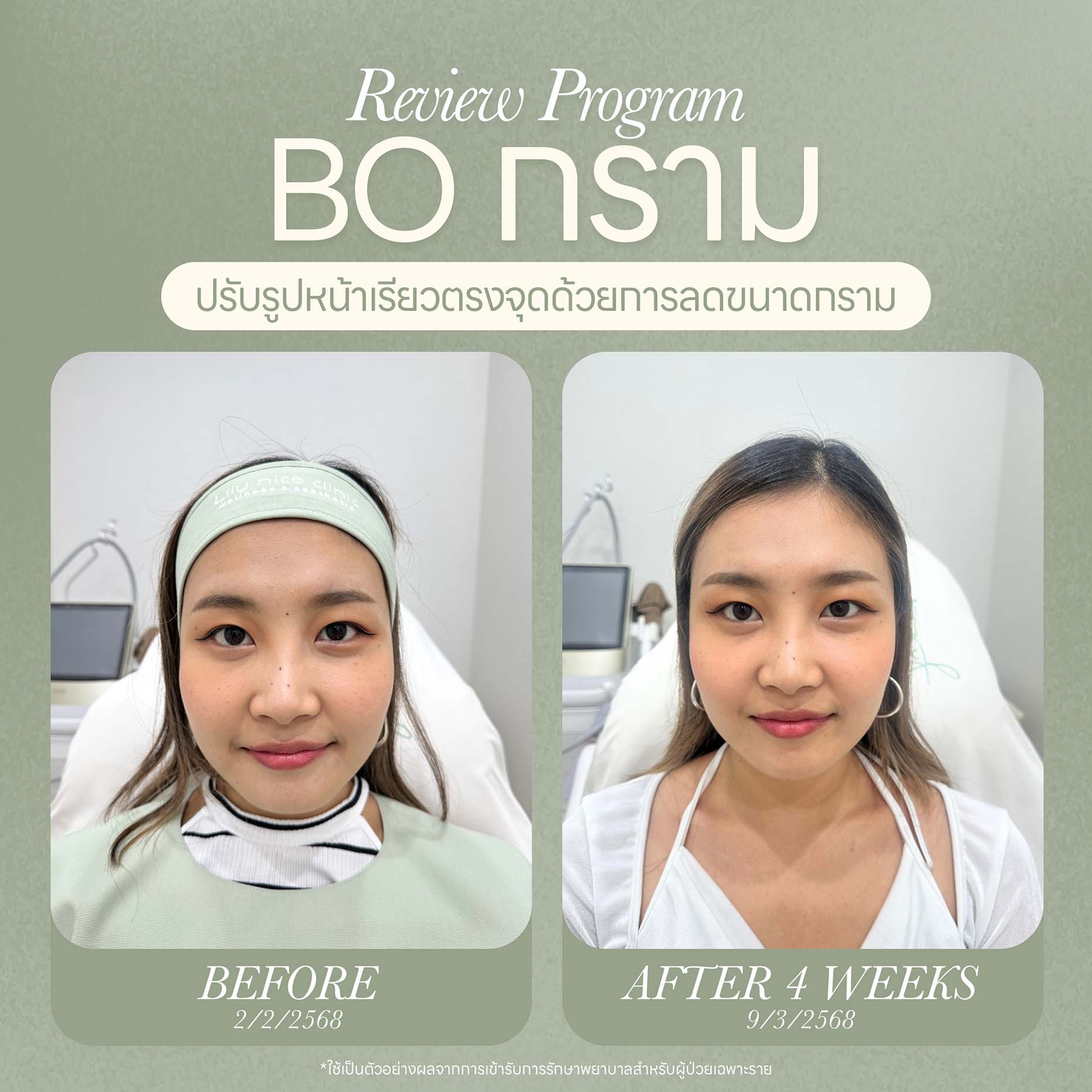 ออกแบบภาพกราฟิก Website 09-25 - Lily Nice Clinic-3